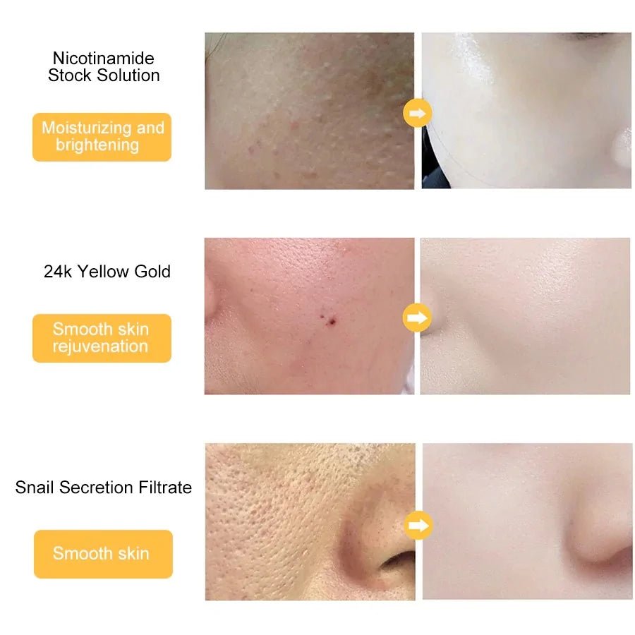 Before and after results of using the BeautyStarts 24k Gold Hyaluronic Acid Face Serum, showing smoother and more radiant skin.