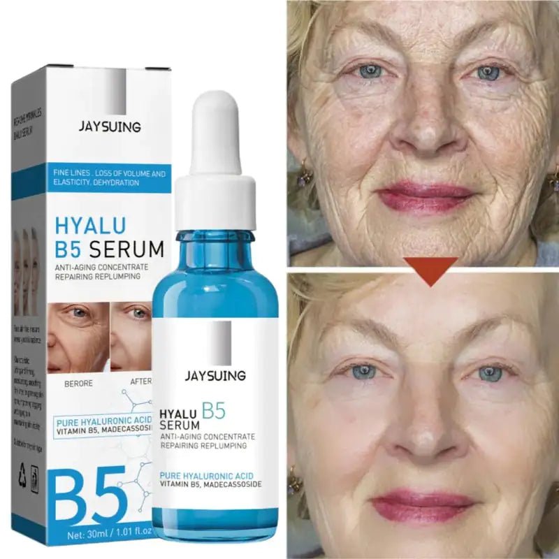 Before and after using BeautyStarts B5 Hyaluronic Acid Serum – Noticeable reduction in fine lines and improved skin texture.