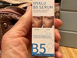 BeautyStarts B5 Hyaluronic Acid Serum held in hand with packaging – Ideal for daily hydration and skin rejuvenation.