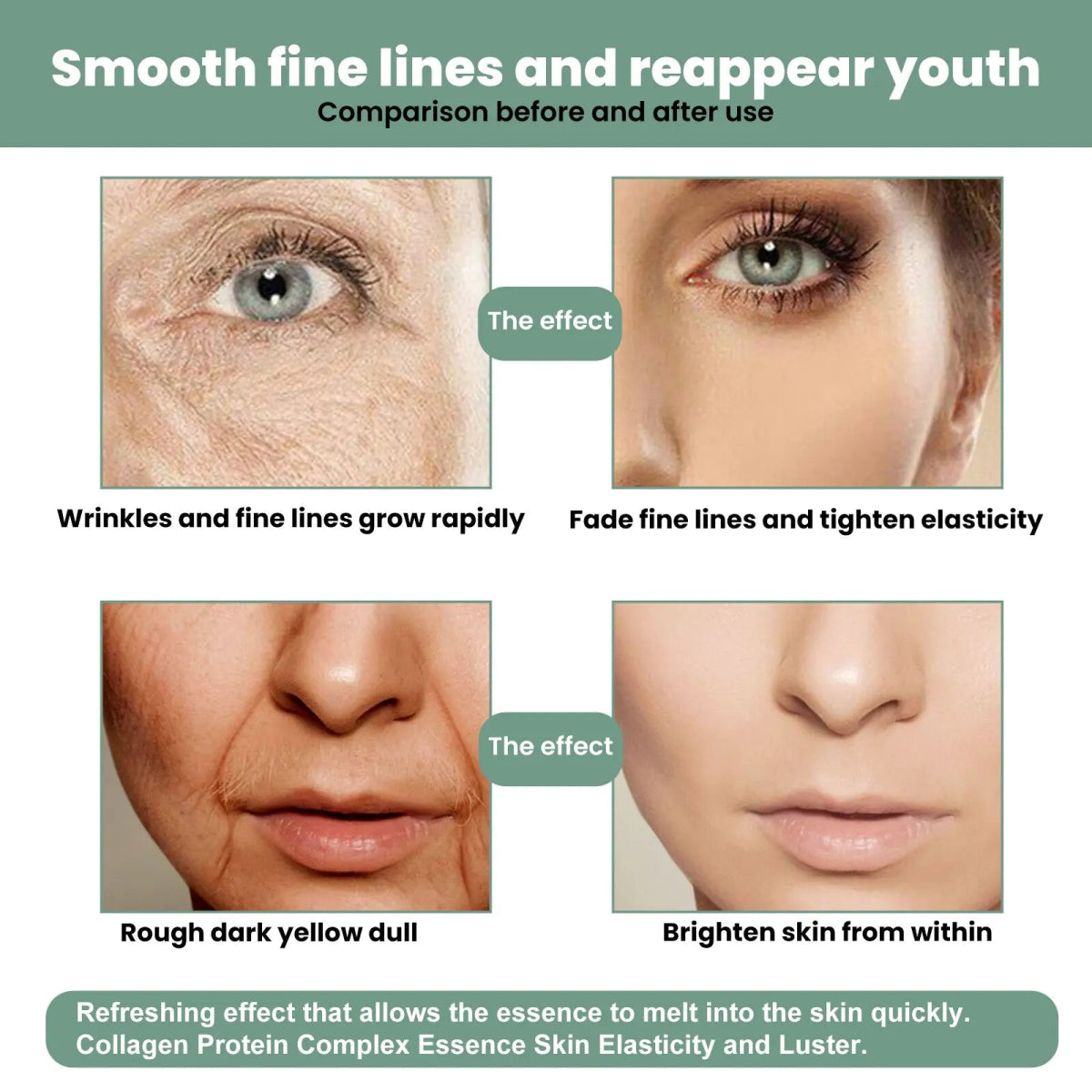 Before and after results using BeautyStarts Advanced Deep Anti-Wrinkle Whitening Serum, showing smoother, brighter skin and reduced wrinkles.