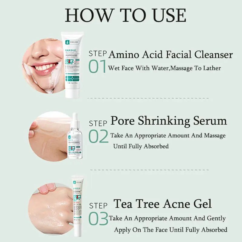 BeautyStarts Anti Acne Removal Kit how-to-use guide, showing the simple steps to follow for clear and acne-free skin.