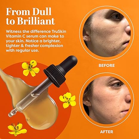 From Dull to Brilliant Skin with Vitamin C Serum – Reveal Your Skin’s Natural Glow – BeautyStarts