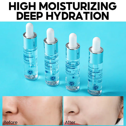 High Moisturizing Hyaluronic Acid Face Serum for Radiant Skin - BeautyStarts
