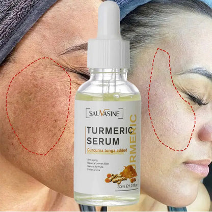 Before and After Results of Using Turmeric Face Whitening Serum – Noticeable Skin Brightening – BeautyStarts