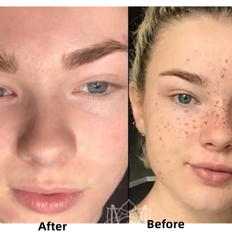 Transformative Before and After Effects of Turmeric Face Whitening Serum – Brightened and Even Skin Tone – BeautyStarts