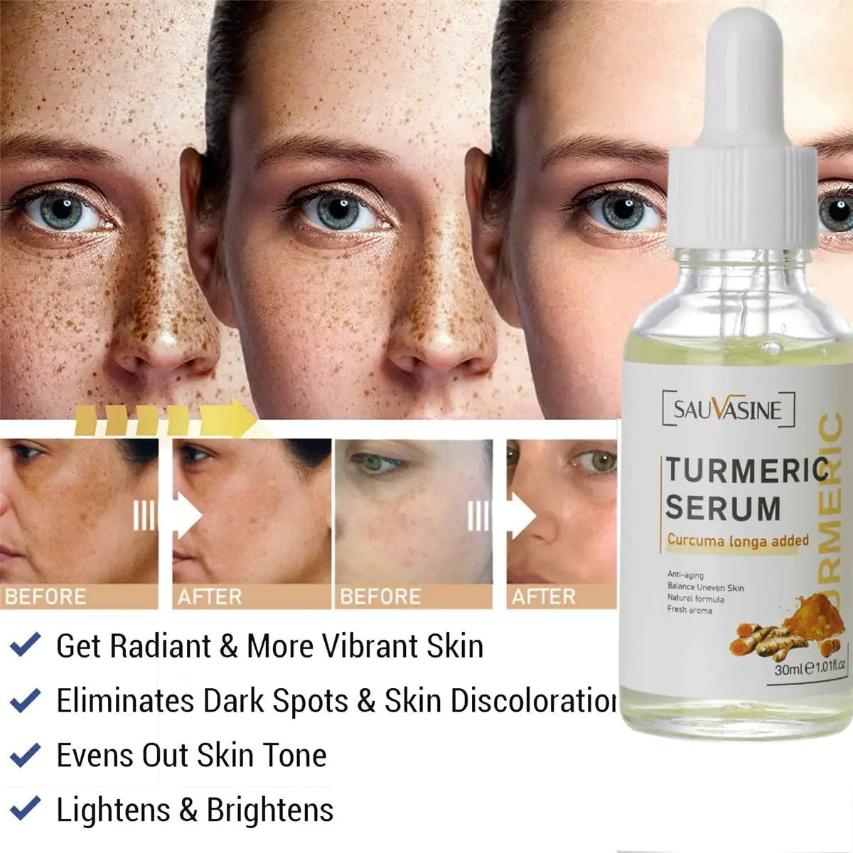 Benefits of Turmeric Face Whitening Serum – Skin Brightening, Even Tone, and Anti-Inflammatory – BeautyStarts