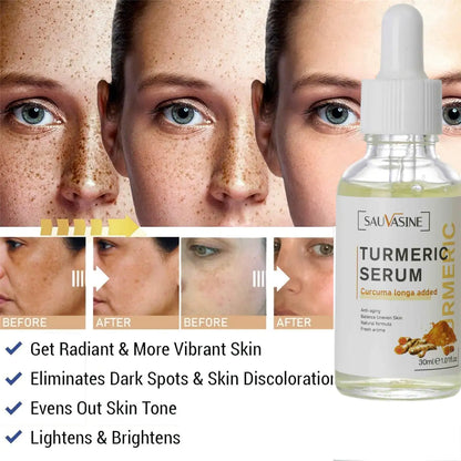 Benefits of Turmeric Face Whitening Serum – Skin Brightening, Even Tone, and Anti-Inflammatory – BeautyStarts